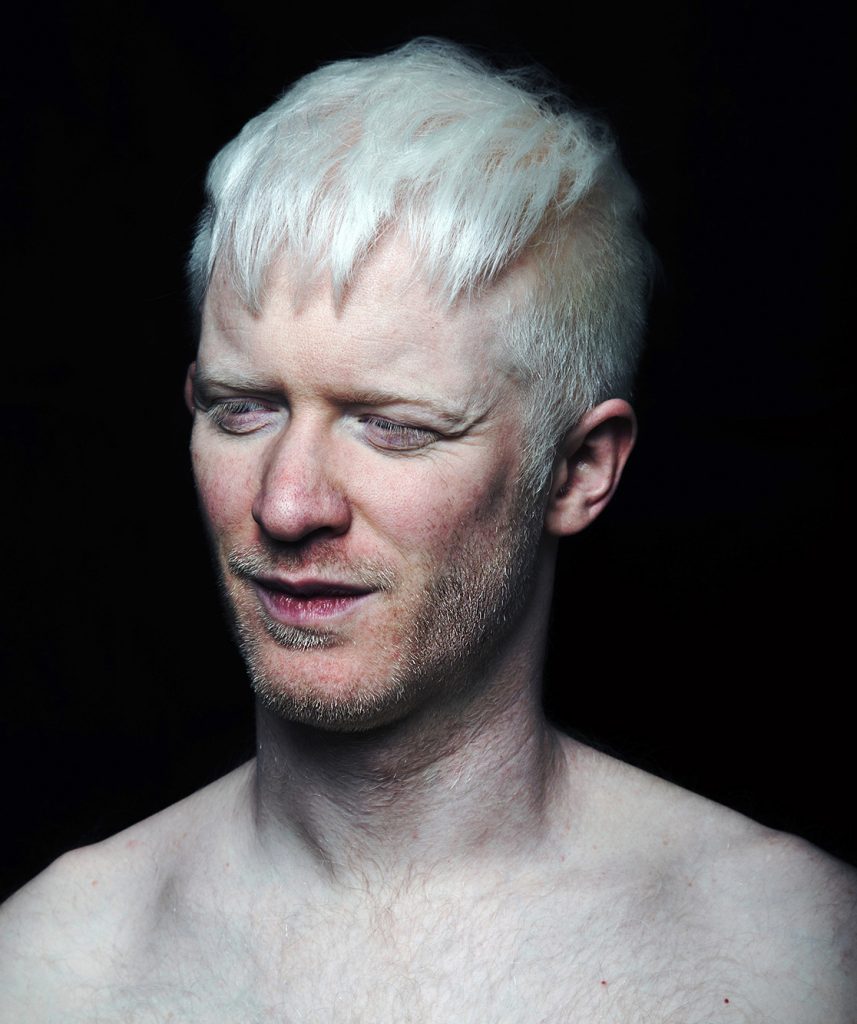 Albino Man; Photography portrait